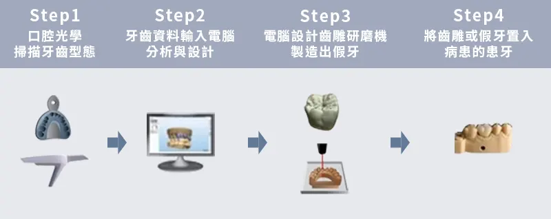 一日3D齒雕流程圖，Step1口腔光學掃描牙齒型態，Step2牙齒資料輸入電腦分析與設計，Step3電腦設計齒雕研磨機製造假牙，Step4將齒雕或假牙置入病患的患牙